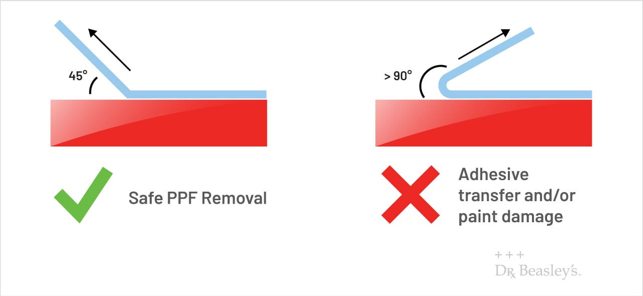 Diagram showing the proper angle for removing PPF.
