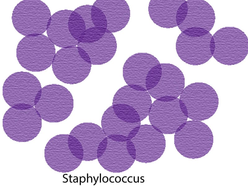 Carpet Germs - Staph